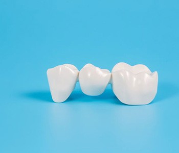Dental bridge resting on blue surface